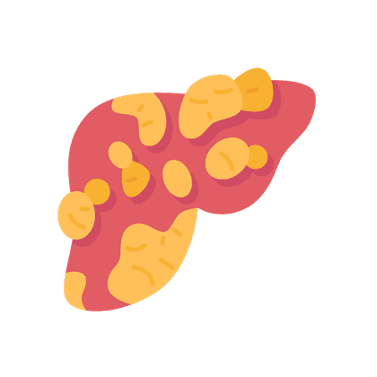 Fatty hepatosis of the liver