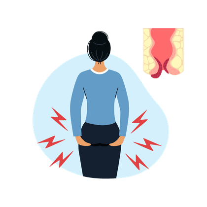Hemorrhoids
