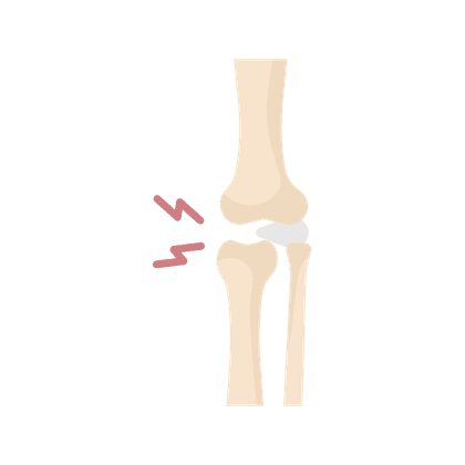 Osteoarthritis